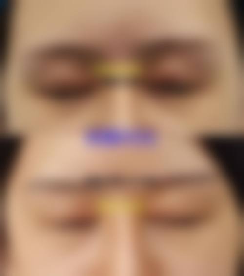 八、北京同仁医院预约方式