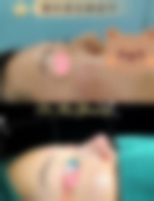 四、济南九紫嘉美整形医院特色项目