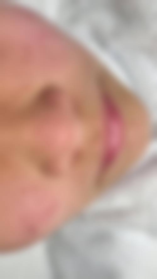 九、威海恩僖医疗美容诊所真实的患者评价