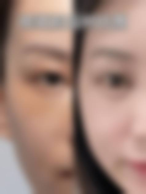 九、韩国THE整形外科真实的患者评价