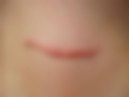 八、广西梧州华美医疗美容门诊部真实的患者评价