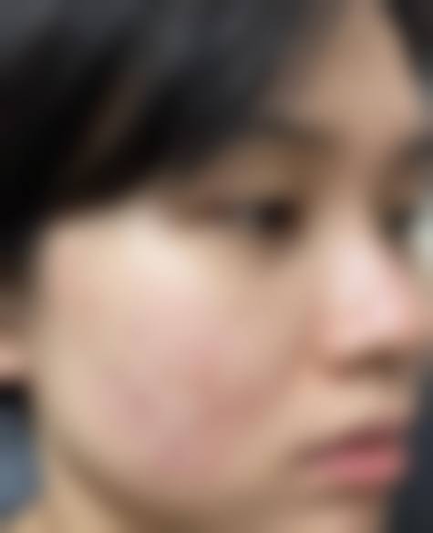 二、吉林省前卫医院皮肤美容科怎么样？