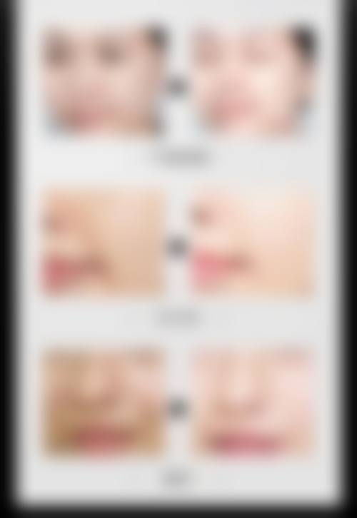 八、济南九紫嘉美整形医院真实的患者评价