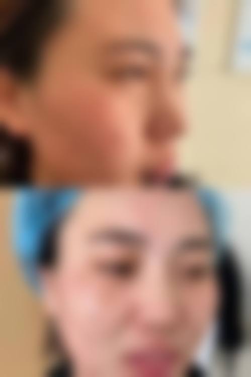 八、宜昌星范医疗美容医院真实的患者评价