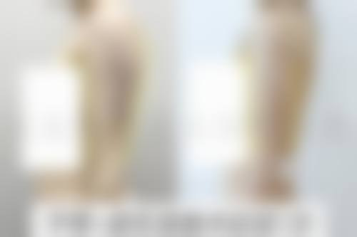 八、桂林新华整形美容诊所真实的患者评价