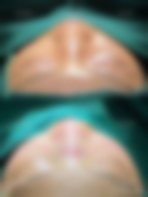 三、吉林省前卫医院皮肤美容科诊疗项目有哪些？