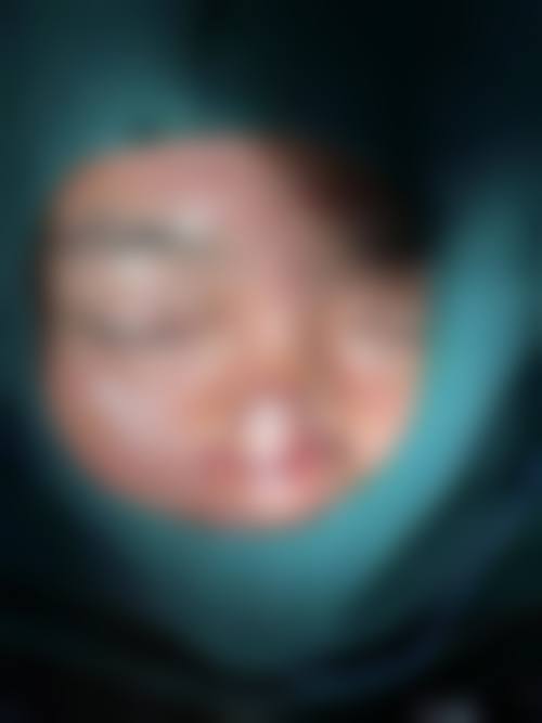 四、宜昌星范医疗美容医院特色项目