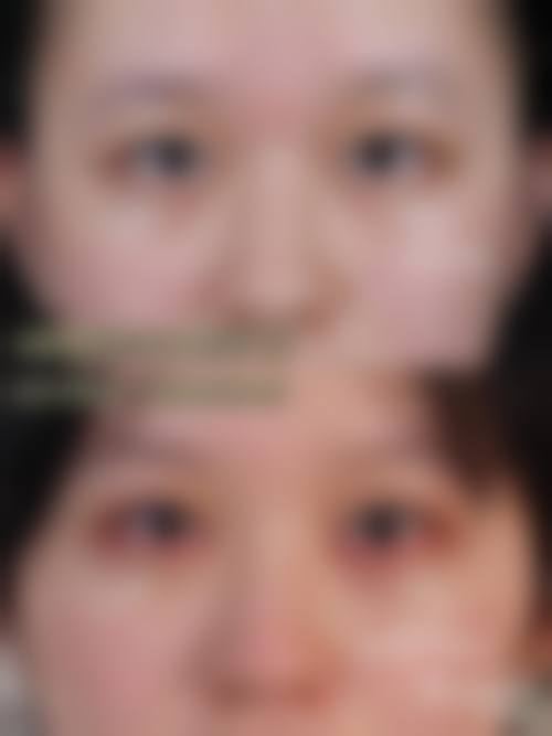 九、南宁市医学美容中 心真实的患者评价