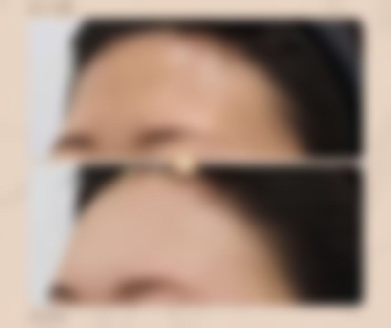 四、韩国 Young & Young 整形外科特色项目