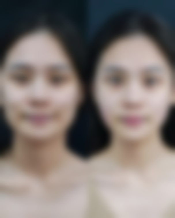 五、疾病与过敏等特殊因素导致的眼袋