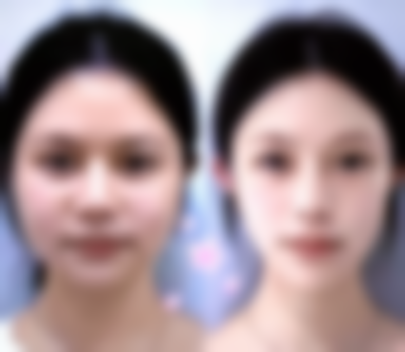 八、镇江友谊医疗美容门诊部真实的患者评价