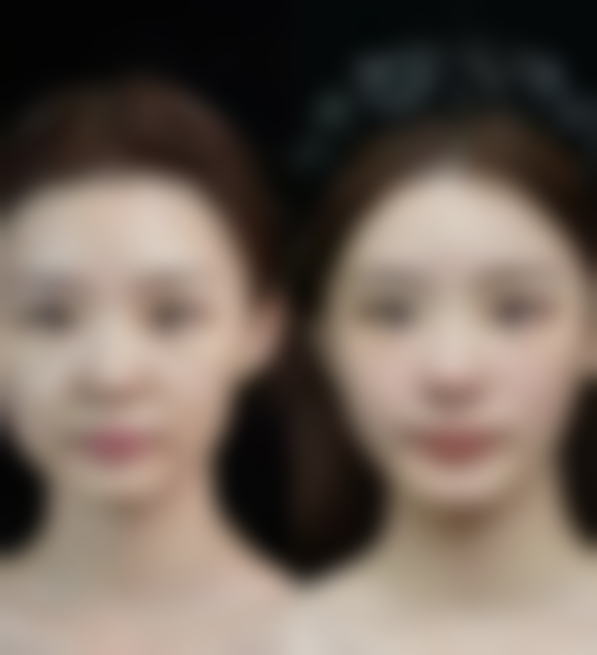 二、韩国 Young & Young 整形外科怎么样？