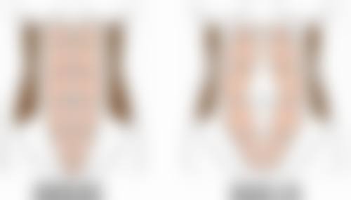 三、个人体质对做双眼皮修复时间的影响