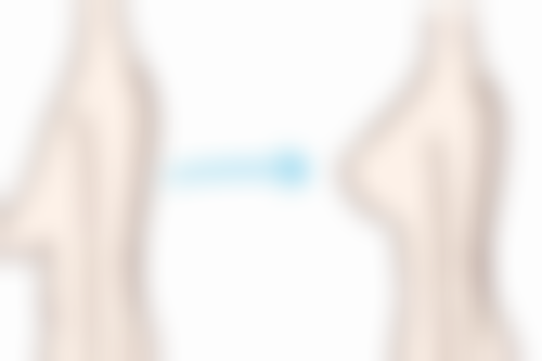 三、水蒸气烫伤的特点及修复时间