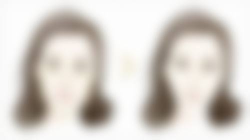 六、保持良好心态加速做双眼皮修复