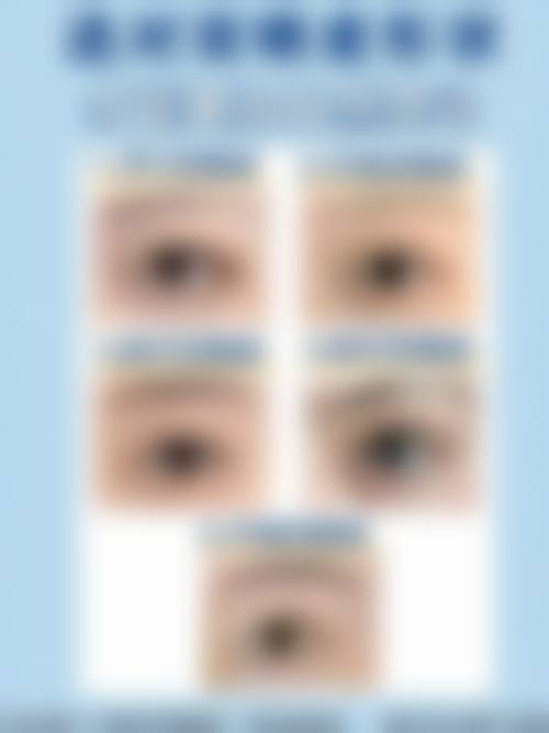 三、昆明延安杰西艾整形医院诊疗项目有哪些？