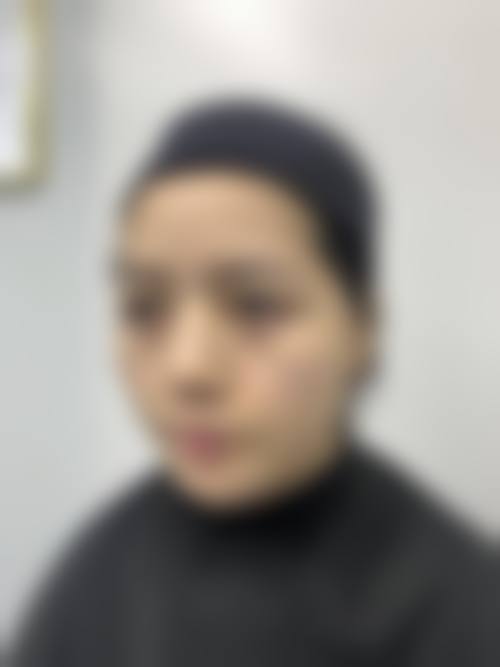 九、长治颜可菁医疗美容医院真实的患者评价