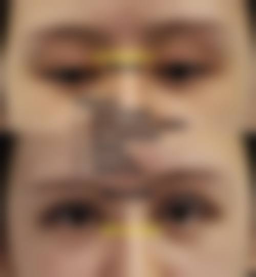 八、连云港市中医院烧伤整形外科真实的患者评价