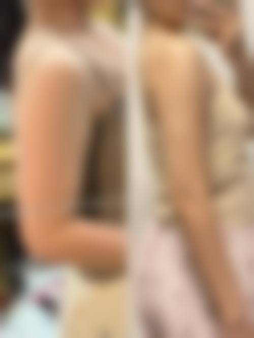 八、中卫伊美姿美容整形外科诊所真实的患者评价