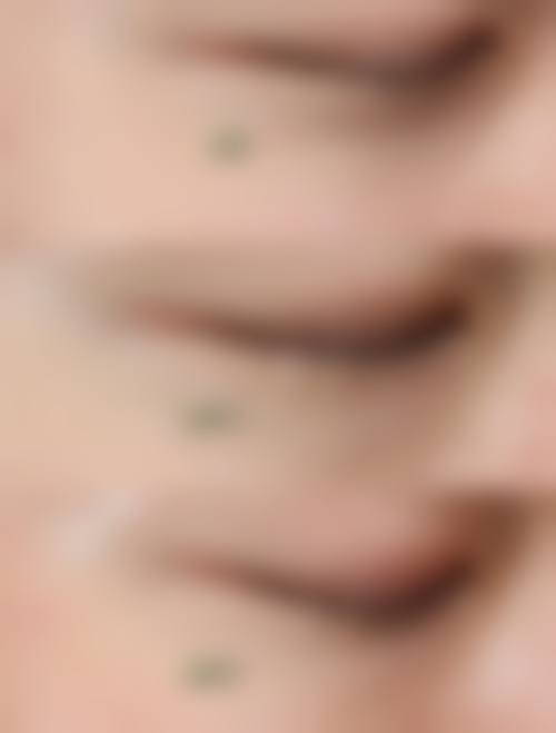 四、昆明延安杰西艾整形医院特色项目