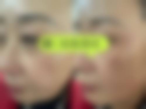 七、昆明延安杰西艾整形医院预约方式