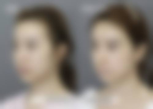 八、东莞天后医疗美容医院真实的患者评价