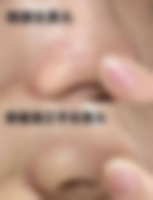 四、武汉慕尔美医疗美容门诊部特色项目