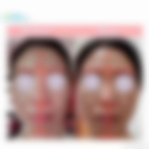 四、北京柏颜整形医院特色项目