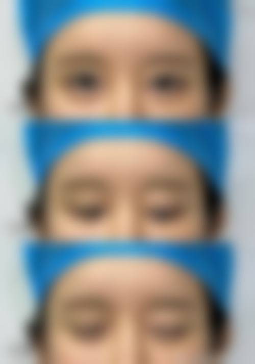 二、北京和颜一美公翠整形医院怎么样？