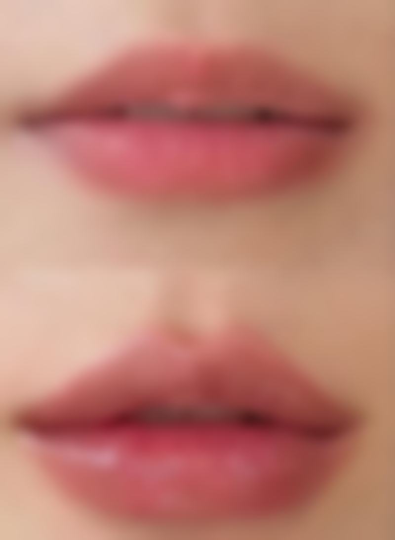 烫伤的疤痕多久能消退？了解不同程度及水蒸气烫伤恢复时间有妙招！ 