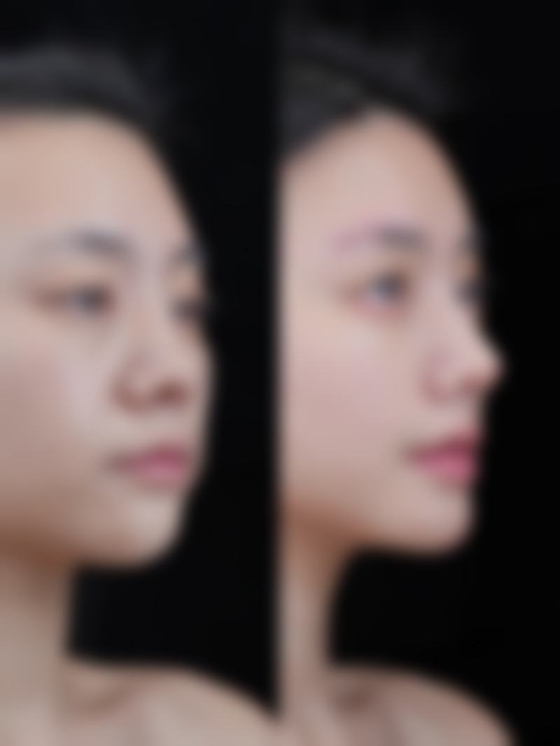 五、北京和颜一美公翠整形医院价格表