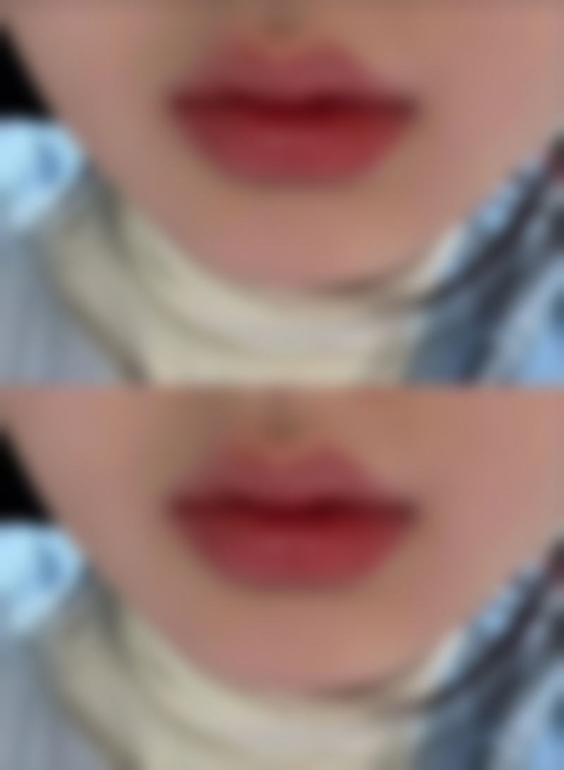 缝过针的疤痕怎么去？多种有效方法助你淡化疤痕、重塑光滑肌肤！ 