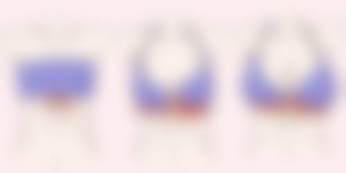 三、影响抽脂术后修复及塑身衣脱穿时间的因素