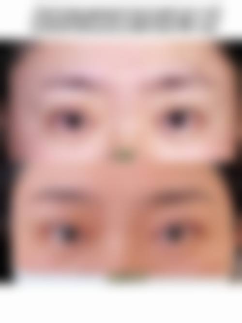 九、杭州悦可医疗美容诊所真实的患者评价