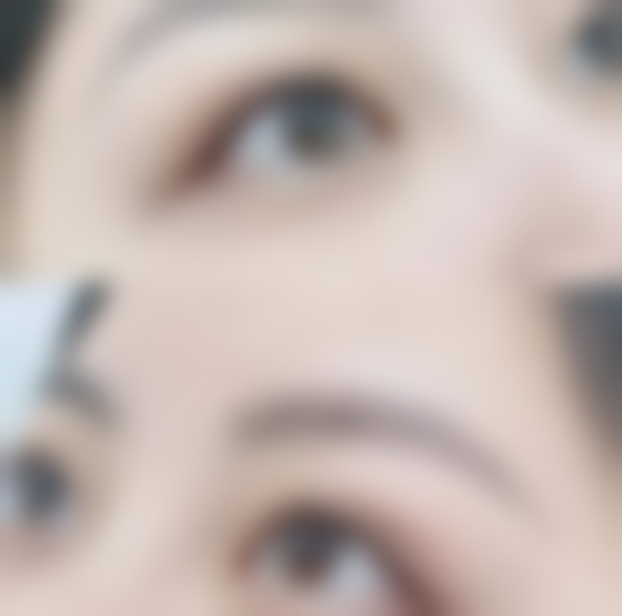 四、做双眼皮一般修复要多久之修复阶段特点