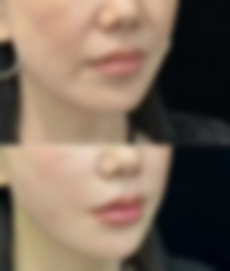 三、日常护理注意事项