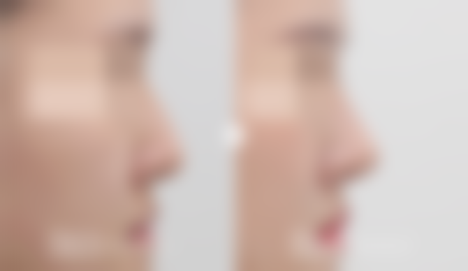 二、韩国玉芭整形外科医院怎么样？