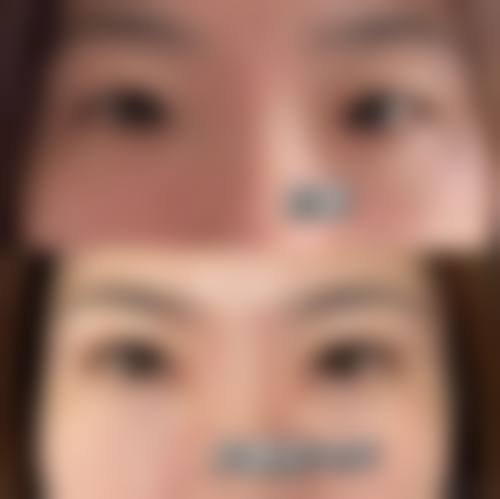 二、韩国SUi整形外科怎么样？