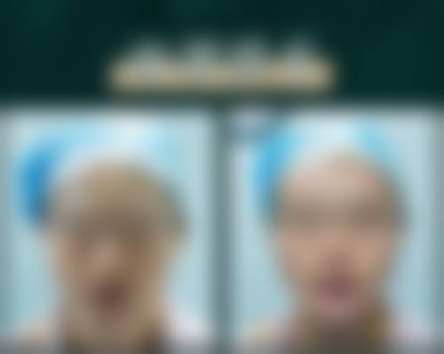 三、黄金龙医生手术技术优势