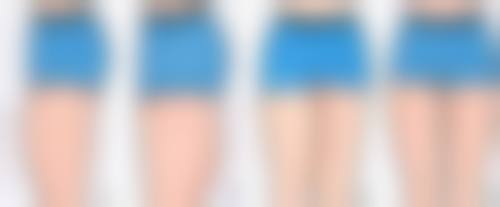 七、无痕去眼袋的注意事项