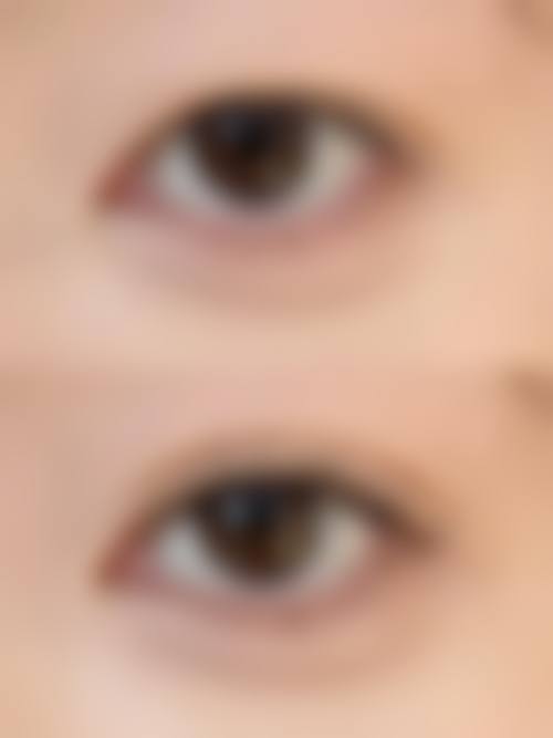 三、韩国SUi整形外科诊疗项目有哪些？