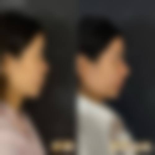 四、深圳刘运奇医疗美容诊所特色项目