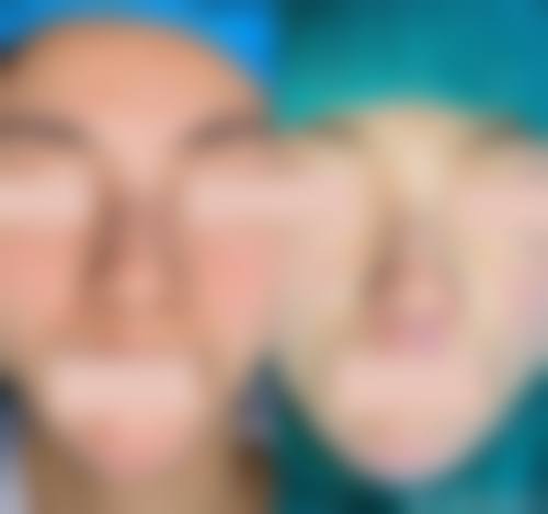 七、海口百龄整形医院预约方式