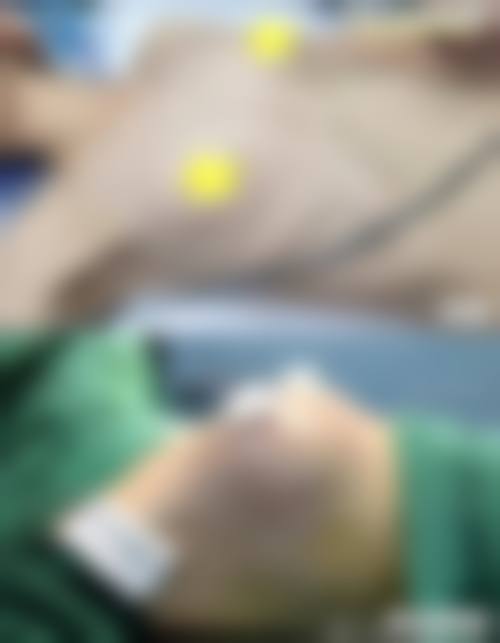 九、保定慕丽卡整形医院真实的患者评价