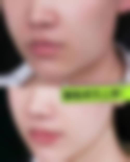 九、郑州羽中医疗美容门诊部真实的患者评价