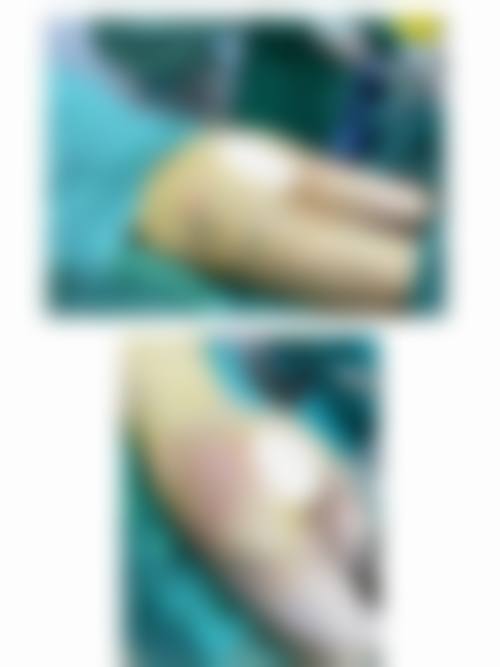 六、四川广元医而美美华整形门诊部价格表