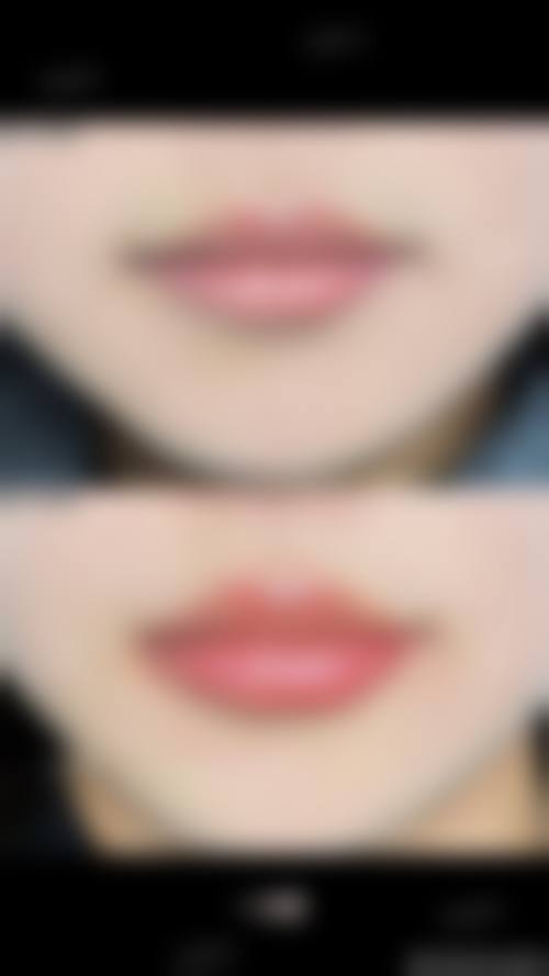 八、西安美人鱼医疗美容医院预约方式