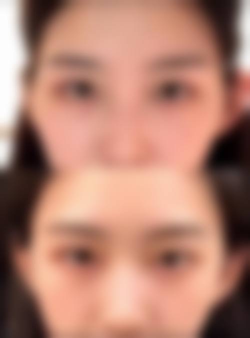 四、深圳健丽医疗美容医院特色项目