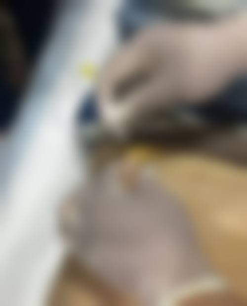 九、韩国蓝天感觉整形外科真实的患者评价