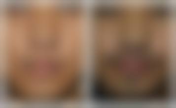 四、韩国蓝天感觉整形外科特色项目